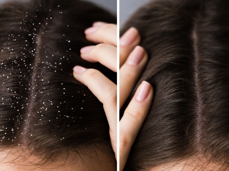 Raintermayo: The Secret to Healthy Hair and Scalp